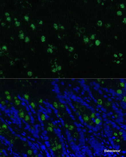 Western blot analysis of extracts of various cell lines using CMKLR1 Polyclonal Antibody at dilution of 1:1000.
