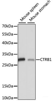 Western blot analysis of extracts of various cell lines using Caspase-7 Polyclonal Antibody at dilution of 1:1000.
