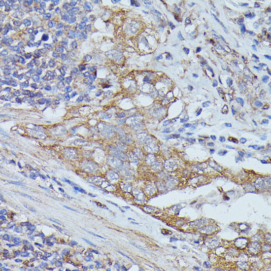 Immunofluorescence analysis of U-2 OS cells using GTF2E1 Polyclonal Antibody at dilution of 1:100 (40x lens). Blue: DAPI for nuclear staining.