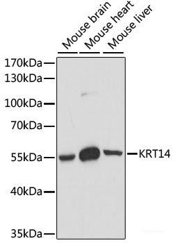 Western blot analysis of extracts of various cell lines using MANBA Polyclonal Antibody at dilution of 1:1000.