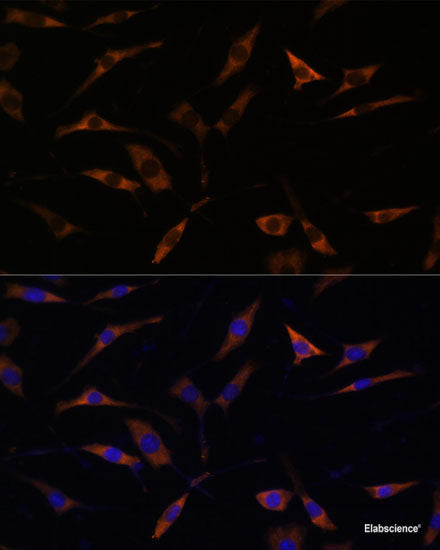 Western blot analysis of extracts of various cell lines using MTMR6 Polyclonal Antibody at dilution of 1:1000.