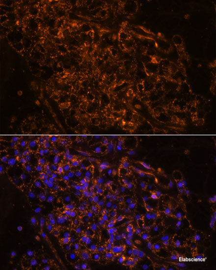 Immunofluorescence analysis of L929 cells using MTMR4 Polyclonal Antibody at dilution of 1:100 (40x lens). Blue: DAPI for nuclear staining.