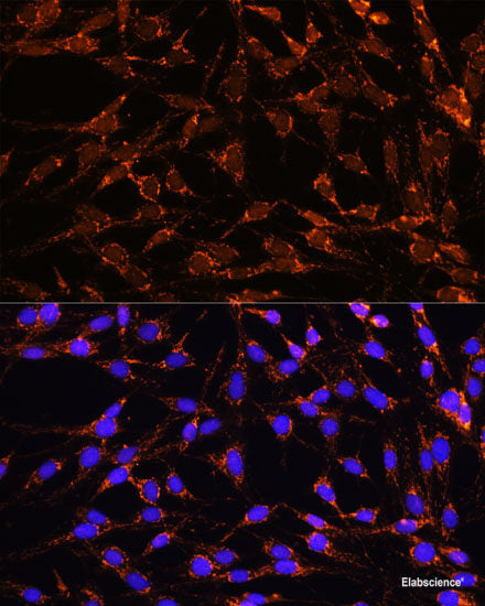 Immunofluorescence analysis of C6 cells using FARSB Polyclonal Antibody at dilution of 1:100. Blue: DAPI for nuclear staining.