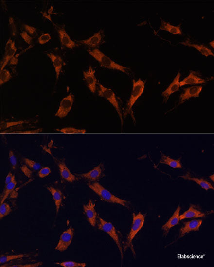 Western blot analysis of extracts of various cell lines using NFAT2 Polyclonal Antibody at dilution of 1:3000.