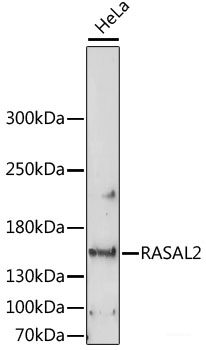Western blot analysis of extracts of various cell lines using AFG3L2 Polyclonal Antibody at dilution of 1:1000.