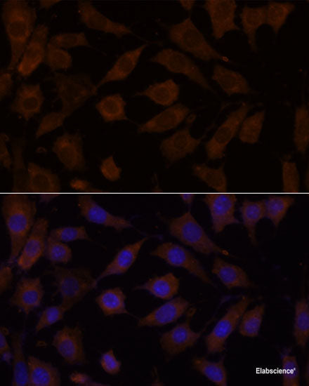 Immunofluorescence analysis of C6 cells using SEC23IP Polyclonal Antibody at dilution of 1:100. Blue: DAPI for nuclear staining.
