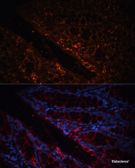 Immunohistochemistry of paraffin-embedded Human stomach using TNFR1 Polyclonal Antibody at dilution of 1:100 (40x lens).