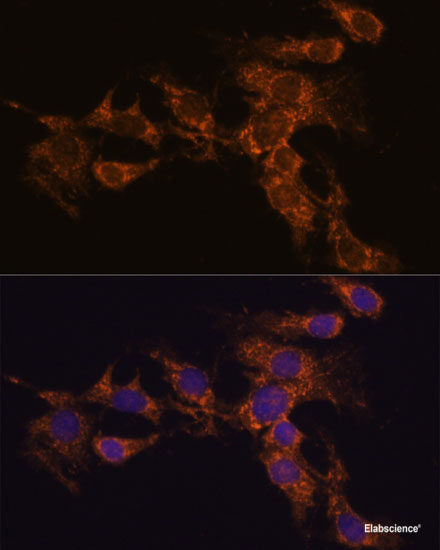 Immunofluorescence analysis of L929 cells using VILL Polyclonal Antibody at dilution of 1:100. Blue: DAPI for nuclear staining.