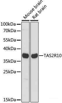 Western blot analysis of extracts of various cell lines using UTP18 Polyclonal Antibody at dilution of 1:1000.