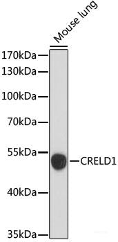 Western blot analysis of extracts of various cell lines using POMK Polyclonal Antibody at dilution of 1:1000.