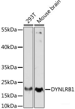 Immunofluorescence analysis of Rat testis using TPD52L3 Polyclonal Antibody at dilution of 1:100. Blue: DAPI for nuclear staining.