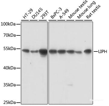 Western blot analysis of extracts of Mouse brain using LC3B Polyclonal Antibody at dilution of 1:1000.