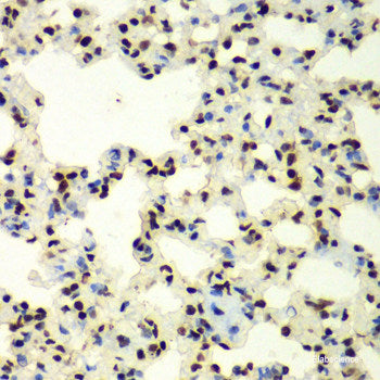 Immunofluorescence analysis of C6 cells using IPO4 Polyclonal Antibody at dilution of 1:100. Blue: DAPI for nuclear staining.
