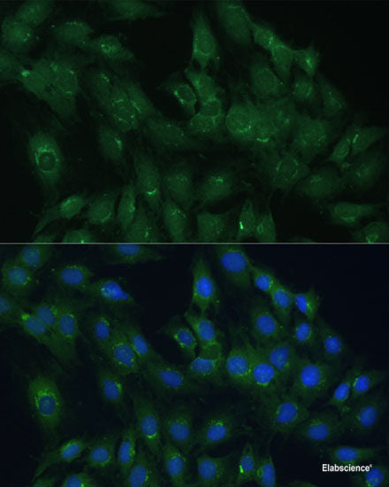 Western blot analysis of extracts of various cell lines using Acetyl-Histone H2B-K12 Polyclonal Antibody at dilution of 1:1000. HeLa cells were treated by TSA (1 uM) at 37°C for 18 hours. C2C12 cells were treated by TSA (1 uM) at 37°C for 18 hours. C6 cells were treated by TSA (1 uM) at 37°C for 18 hours.