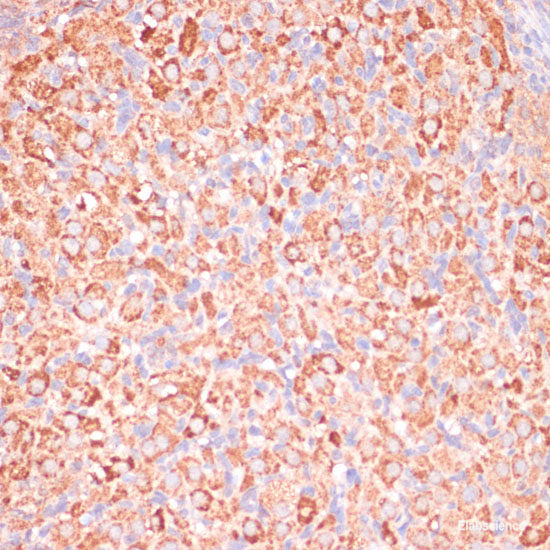 Immunofluorescence analysis of MCF-7 cells using beta 2 Microglobulin Polyclonal Antibody