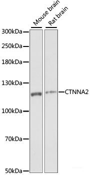 Immunohistochemistry of paraffin-embedded Human breast using Acetyl-Histone H2A-K5 Polyclonal Antibody at dilution of 1:100 (40x lens).