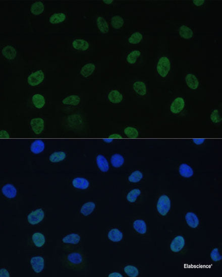 Western blot analysis of extracts of various cell lines using Acetyl-Histone H2B-K15 Polyclonal Antibody at dilution of 1:1000. HeLa cells were treated by TSA (1 uM) at 37°C for 18 hours. NIH/3T3 cells were treated by TSA (1 uM) at 37°C for 18 hours. C6 cells were treated by TSA (1 uM) at 37°C for 18 hours.