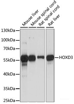 Western blot analysis of extracts of various cell lines using GITR/TNFRSF18 Polyclonal Antibody at dilution of 1:3000.