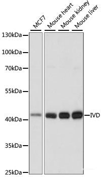 Western blot analysis of extracts of various cell lines using IMPDH2 Polyclonal Antibody at dilution of 1:1000.
