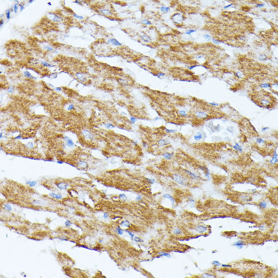 Immunohistochemistry of paraffin-embedded Rat brain using RNF149 Polyclonal Antibody at dilution of 1:100 (40x lens).