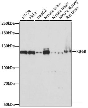 Western blot analysis of extracts of U-937 cells using NAT1 Polyclonal Antibody at dilution of 1:1000.