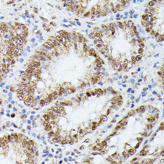 Immunofluorescence analysis of HeLa cells using CANX Polyclonal Antibody at dilution of 1:100. Blue: DAPI for nuclear staining.