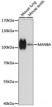 Western blot analysis of extracts of various cell lines using p27 KIP 1 Polyclonal Antibody at dilution of 1:3000.