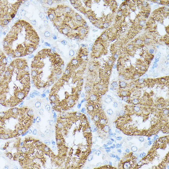 Immunohistochemistry of paraffin-embedded Rat heart using SLC25A5 Polyclonal Antibody at dilution of 1:100 (40x lens).