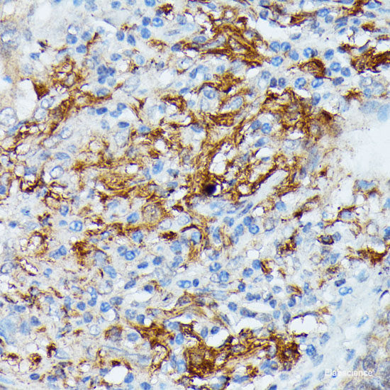 Immunofluorescence analysis of U2OS cells using RHOA Polyclonal Antibody at dilution of 1:100. Blue: DAPI for nuclear staining.