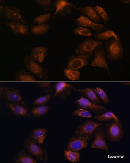 Immunofluorescence analysis of U2OS cells using ATM Polyclonal Antibody at dilution of 1:100. Blue: DAPI for nuclear staining.