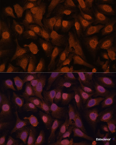 Western blot analysis of extracts of Mouse testis using TSPO Polyclonal Antibody at dilution of 1:1000.