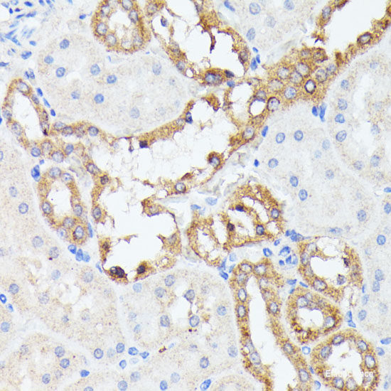 Immunohistochemistry of paraffin-embedded Rat bone marrow using CAMP Polyclonal Antibody at dilution of 1:200 (40x lens).
