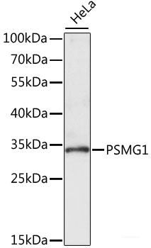 Immunohistochemistry of paraffin-embedded Rat brain using ENTPD6 Polyclonal Antibody at dilution of 1:100 (40x lens).