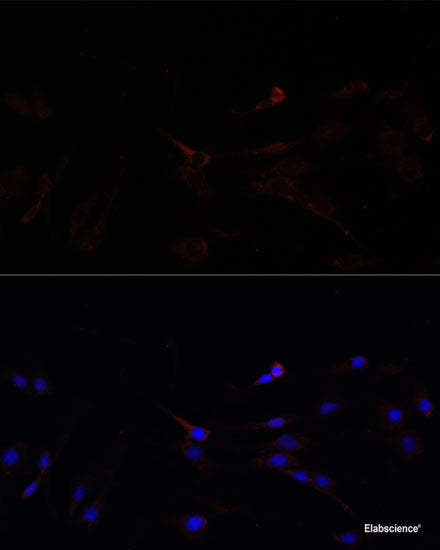 Western blot analysis of extracts of various cell lines using CDC20 Polyclonal Antibody at dilution of 1:1000.
