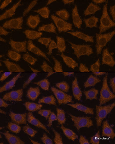Western blot analysis of extracts of Mouse plasma using CRP Polyclonal Antibody at dilution of 1:1000.