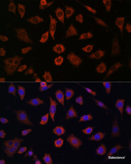 Immunohistochemistry of paraffin-embedded Human liver damage using BSG Polyclonal Antibody at dilution of 1:200 (40x lens).