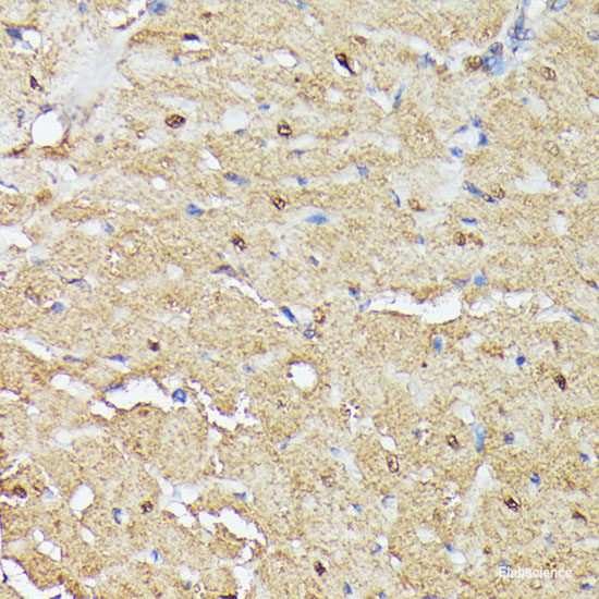 Immunofluorescence analysis of U2OS cells using CSF3 Polyclonal Antibody at dilution of 1:100. Blue: DAPI for nuclear staining.