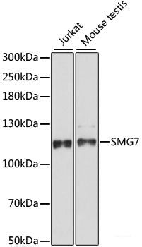 Immunofluorescence analysis of U2OS cells using GNAI3 Polyclonal Antibody at dilution of 1:100. Blue: DAPI for nuclear staining.