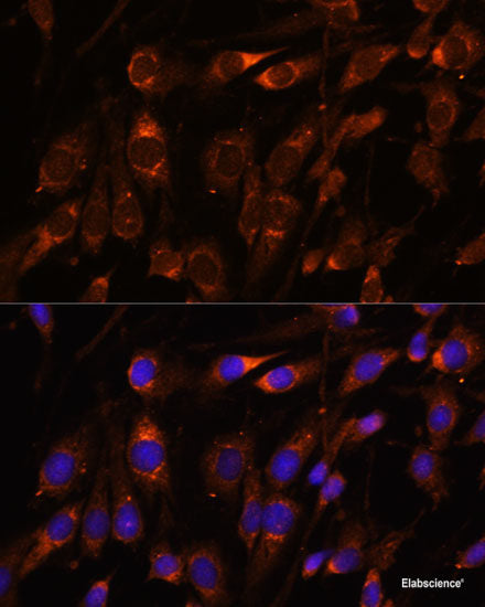 Immunohistochemistry of paraffin-embedded Rat liver using HNRNPD Polyclonal Antibody at dilution of 1:100 (40x lens).