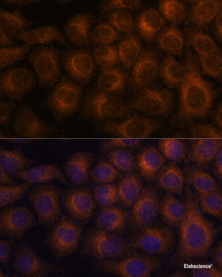 Western blot analysis of extracts of various cell lines using LIPE Polyclonal Antibody at dilution of 1:1000.