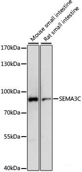 Immunofluorescence analysis of U2OS cells using MMP14 Polyclonal Antibody at dilution of 1:100. Blue: DAPI for nuclear staining.