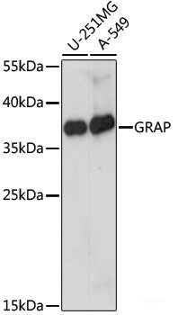 Immunofluorescence analysis of L929 cells using NDUFA4 Polyclonal Antibody at dilution of 1:100 (40x lens). Blue: DAPI for nuclear staining.