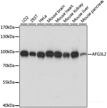 Immunofluorescence analysis of U2OS cells using YBX1 Polyclonal Antibody at dilution of 1:100. Blue: DAPI for nuclear staining.