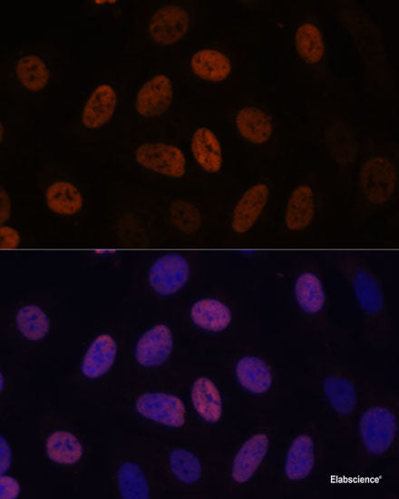 Western blot analysis of extracts of various cell lines using SERPINI1 Polyclonal Antibody at dilution of 1:1000.