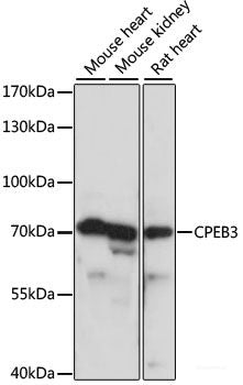Immunofluorescence analysis of U2OS cells using PRKAB1 Polyclonal Antibody at dilution of 1:100. Blue: DAPI for nuclear staining.