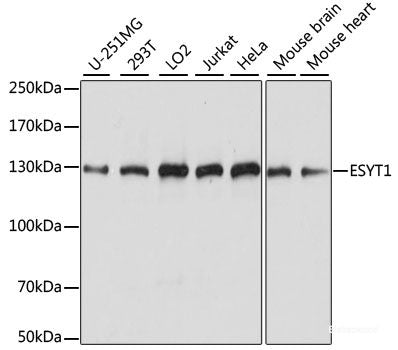Western blot analysis of extracts of various cell lines using P90RSK Polyclonal Antibody at dilution of 1:1000.