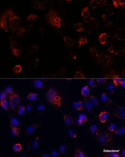 Immunofluorescence analysis of U2OS cells using RPS6KB1 Polyclonal Antibody at dilution of 1:100. Blue: DAPI for nuclear staining.