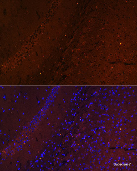 Immunohistochemistry of paraffin-embedded Human placenta using RPS13 Polyclonal Antibody at dilution of 1:100 (40x lens).