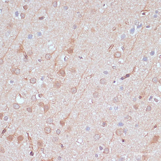 Immunofluorescence analysis of U2OS cells using STAT3 Polyclonal Antibody at dilution of 1:100. Blue: DAPI for nuclear staining.