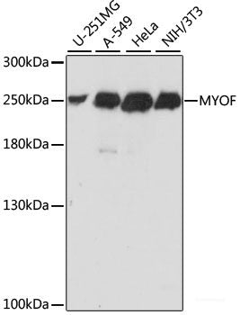 Immunofluorescence analysis of 293T cells using A2M Polyclonal Antibody at dilution of 1:100 (40x lens). Blue: DAPI for nuclear staining.